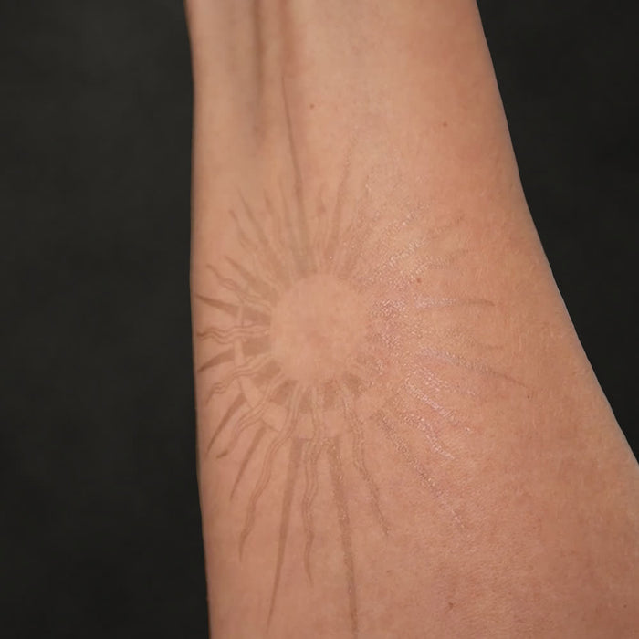 Tattoo right after peeling, still light